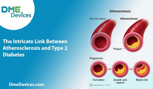 Atherosclerosis and Type 2 Diabetes