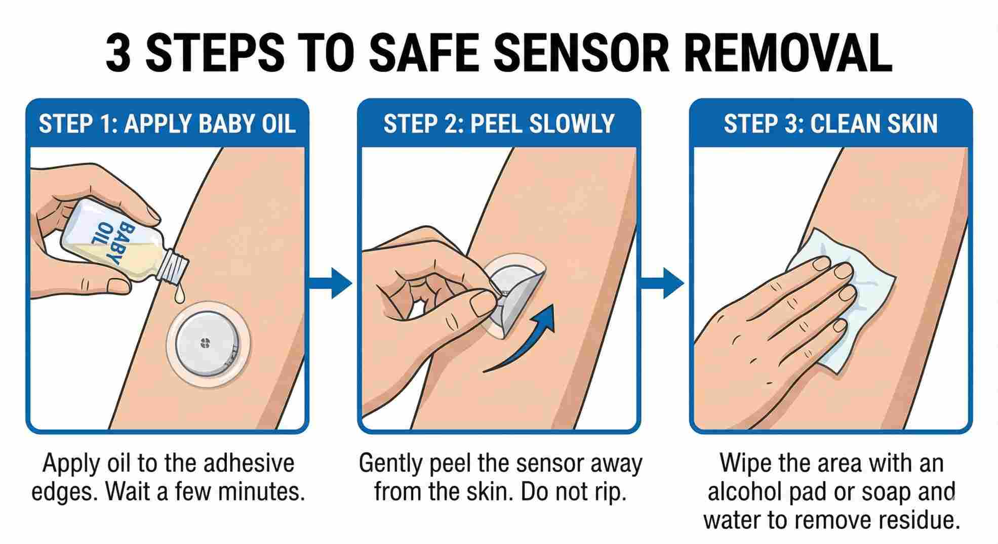 How to remove FreeStyle Libre 3 sensor safely